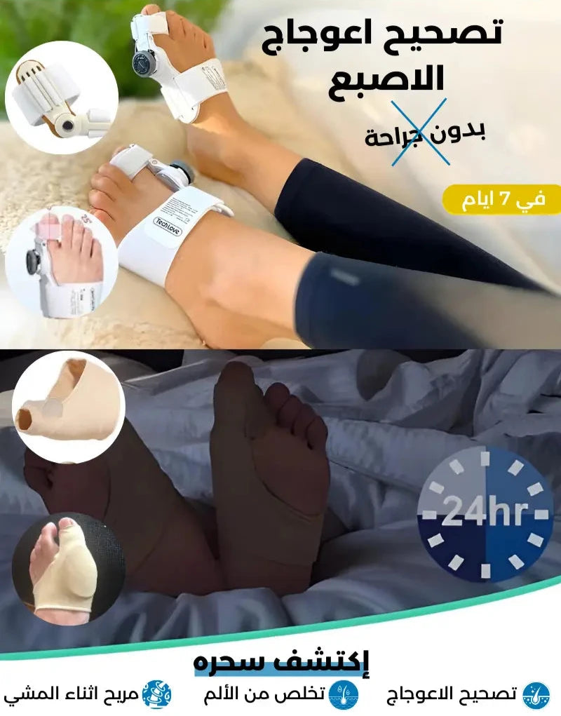 اعوجاج الاصبع