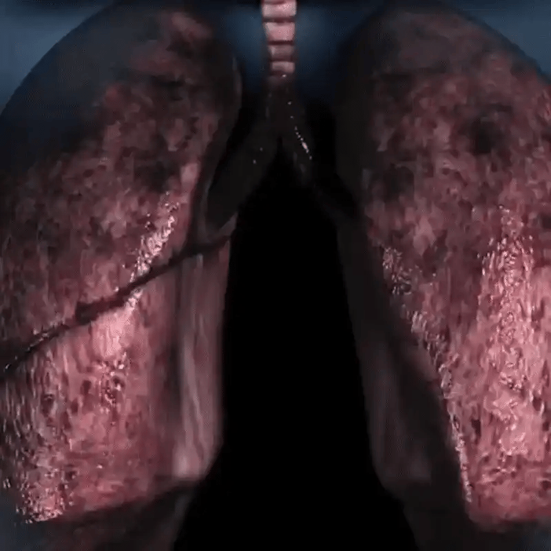 جهاز الأصلي لتقوية الرئة والتنفس 🫁 – Respiratory Trainer