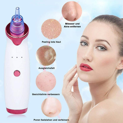 جهاز لإزالة الرؤوس السوداء